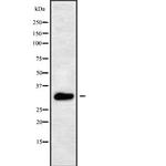 Aquaporin 10 Antibody in Western Blot (WB)