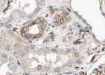 Aquaporin 6 Antibody in Immunohistochemistry (Paraffin) (IHC (P))