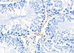 ATP5G1 Antibody in Immunohistochemistry (Paraffin) (IHC (P))