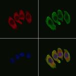 ABCC9 Antibody in Immunocytochemistry (ICC/IF)