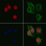 RECQ4 Antibody in Immunocytochemistry (ICC/IF)