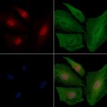 DDX42 Antibody in Immunocytochemistry (ICC/IF)