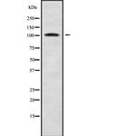 DDX42 Antibody in Western Blot (WB)