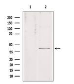 Kir4.1 (KCNJ10) Antibody in Western Blot (WB)