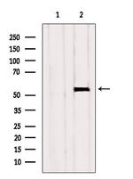 GCNT4 Antibody in Western Blot (WB)