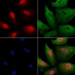 PCP4 Antibody in Immunocytochemistry (ICC/IF)