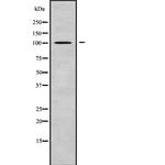 BCAS3 Antibody in Western Blot (WB)