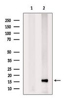 PPP3R1 Antibody in Western Blot (WB)