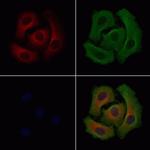 SLC25A13 Antibody in Immunocytochemistry (ICC/IF)