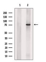 SLC25A13 Antibody in Western Blot (WB)