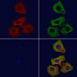 Calpain 6 Antibody in Immunocytochemistry (ICC/IF)