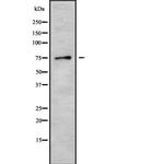 Calpain 6 Antibody in Western Blot (WB)