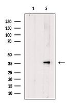 Calponin 3 Antibody in Western Blot (WB)