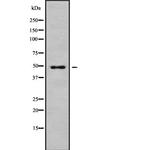 CHST12 Antibody in Western Blot (WB)