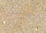 CHST5 Antibody in Immunohistochemistry (Paraffin) (IHC (P))