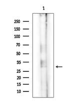 CHST5 Antibody in Western Blot (WB)