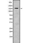 Carboxypeptidase D Antibody in Western Blot (WB)