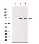 SLC7A3 Antibody in Western Blot (WB)