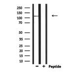 CCP110 Antibody in Western Blot (WB)