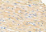 CCP110 Antibody in Immunohistochemistry (Paraffin) (IHC (P))