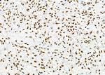 DHRS1 Antibody in Immunohistochemistry (Paraffin) (IHC (P))