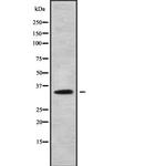 DHRS9 Antibody in Western Blot (WB)