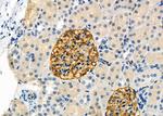 POLG Antibody in Immunohistochemistry (Paraffin) (IHC (P))