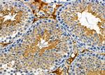 POLG Antibody in Immunohistochemistry (Paraffin) (IHC (P))