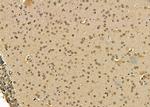 POLR3G Antibody in Immunohistochemistry (Paraffin) (IHC (P))