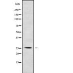 POLR3G Antibody in Western Blot (WB)