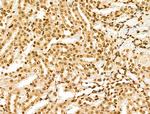 POLR1D Antibody in Immunohistochemistry (Paraffin) (IHC (P))