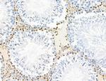 POLR1D Antibody in Immunohistochemistry (Paraffin) (IHC (P))