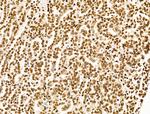 POLR1D Antibody in Immunohistochemistry (Paraffin) (IHC (P))