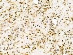 POLR1D Antibody in Immunohistochemistry (Paraffin) (IHC (P))