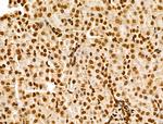 POLR1D Antibody in Immunohistochemistry (Paraffin) (IHC (P))