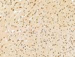 POLR1D Antibody in Immunohistochemistry (Paraffin) (IHC (P))