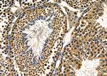 POLR2H Antibody in Immunohistochemistry (Paraffin) (IHC (P))