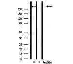 HECTD1 Antibody in Western Blot (WB)