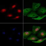 RNF41 Antibody in Immunocytochemistry (ICC/IF)