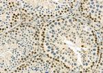 RNF41 Antibody in Immunohistochemistry (Paraffin) (IHC (P))