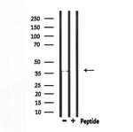 RNF41 Antibody in Western Blot (WB)