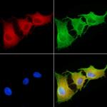 RNF5 Antibody in Immunocytochemistry (ICC/IF)