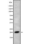 RNF5 Antibody in Western Blot (WB)