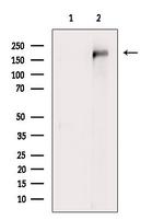 UBR2 Antibody in Western Blot (WB)