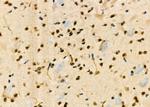 ELP3 Antibody in Immunohistochemistry (Paraffin) (IHC (P))