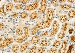 ELP3 Antibody in Immunohistochemistry (Paraffin) (IHC (P))