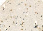 ELP3 Antibody in Immunohistochemistry (Paraffin) (IHC (P))