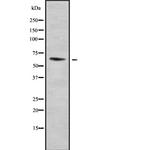 ELP3 Antibody in Western Blot (WB)