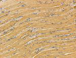 HSD17B12 Antibody in Immunohistochemistry (Paraffin) (IHC (P))