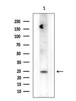 HSD17B12 Antibody in Western Blot (WB)